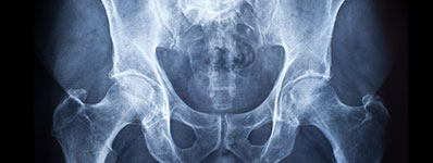 Bone and mineral disease.